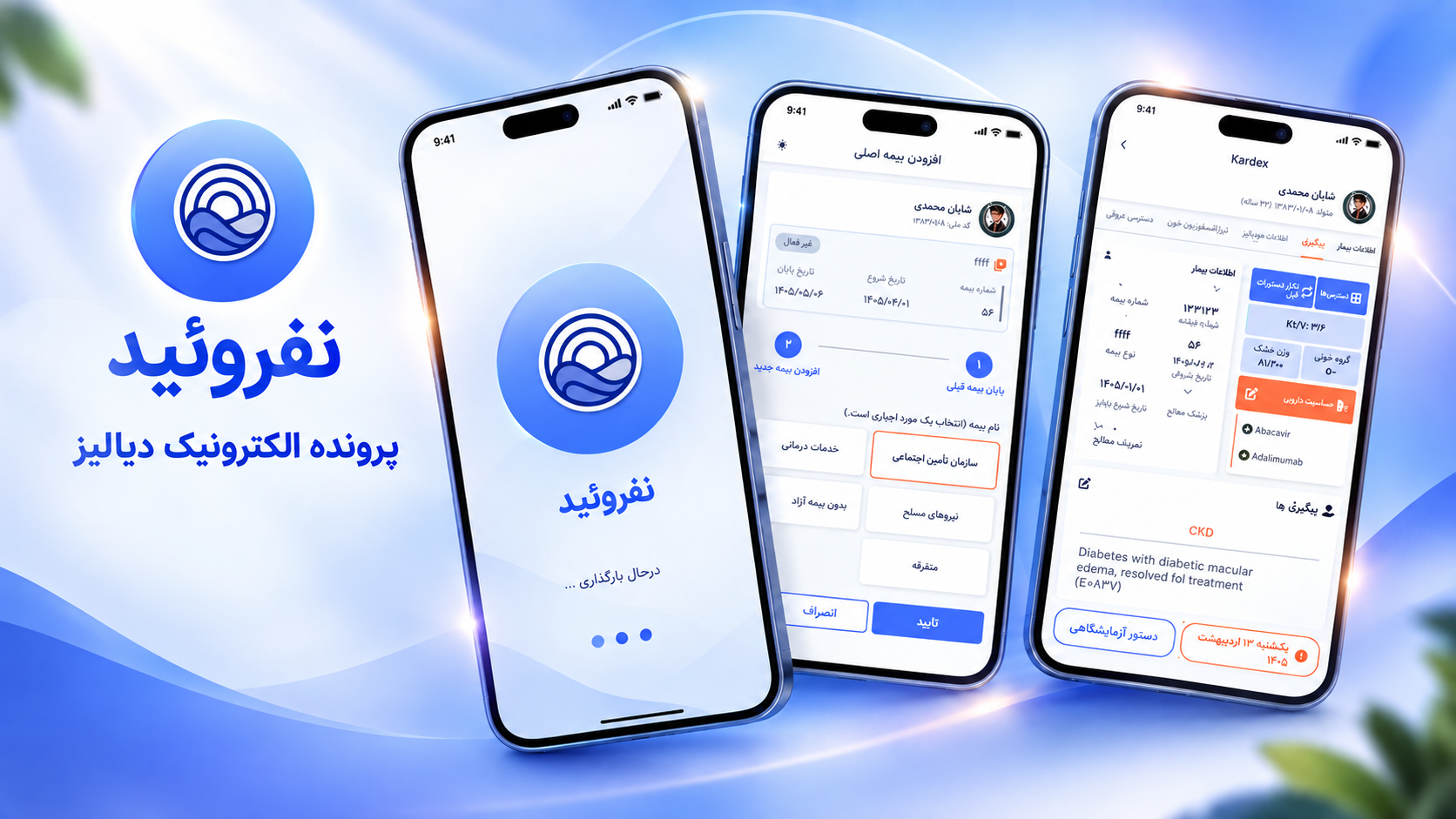 نفروئید